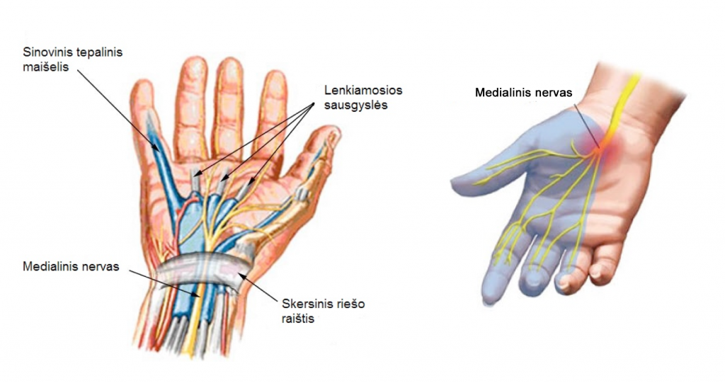 rankų skausmas kai lankstymo skauda sąnario blauzdos