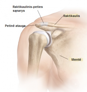 skausmas ir peties sąnario gydymas reumatoidinis artritas pažeidimas sąnarių funkcija