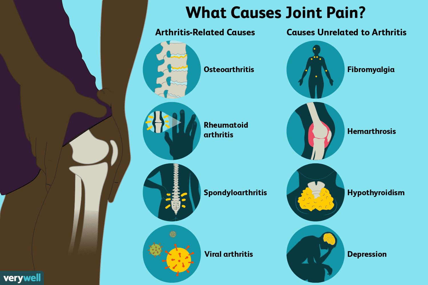 swollen painful stiff joints